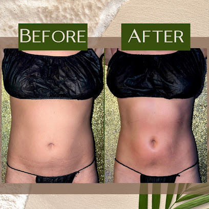 Photo 3 of Siren Curves Body Sculpting