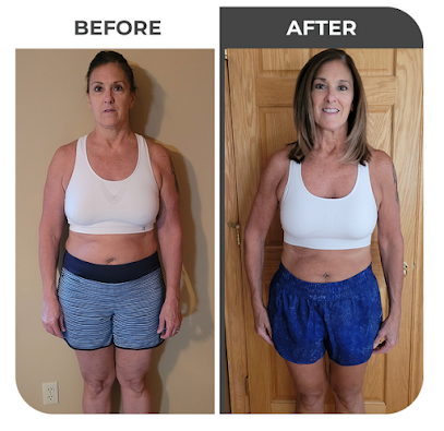 Photo 4 of Salt Lake City Fat Loss