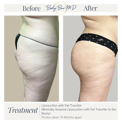 Photo 2 of BodyBarMD