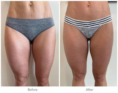Photo 3 of Ageless Sculpting and Wellness