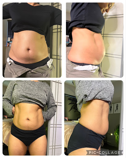 Natural Rejuvenation MedSpa