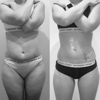 Body Rock Sculpting Med Spa