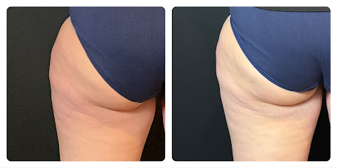 Photo 2 of TruYou Body Renewal