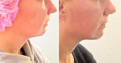 Body Wellness & Body Contouring