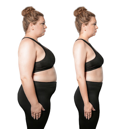 Slimmetry Medical Center