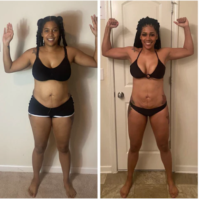 Photo 3 of Scale Down, LLC - Weight Loss Clinic