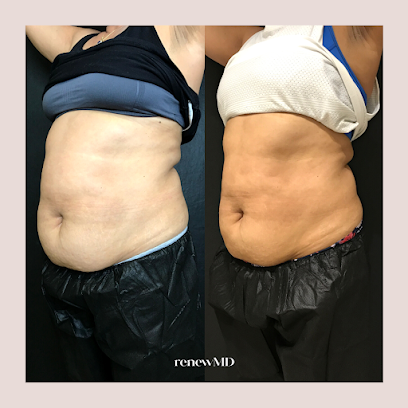 Photo 2 of RenewMD Beauty and Wellness