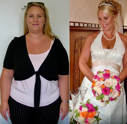 The Weight Loss Surgery Center of Los Angeles
