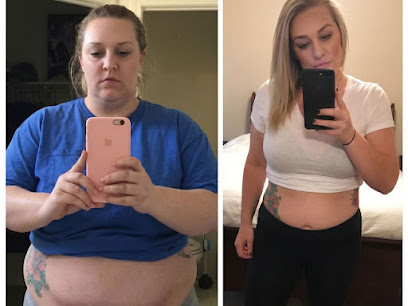 Photo 3 of Yevo Semaglutide & Weight Loss of Downey
