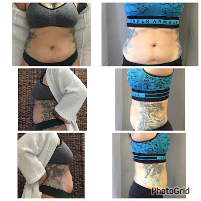 Photo 2 of Body Techs Wellness & Esthetics