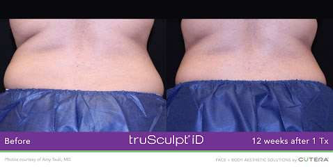 Skinny Secrets - #1 Non-Surgical Body Sculpting in ABQ