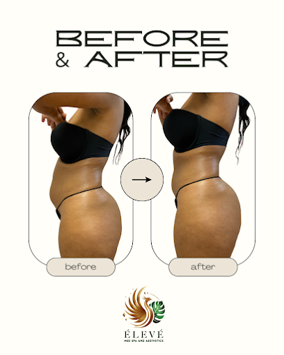 Élevé Med Spa & Aesthetics