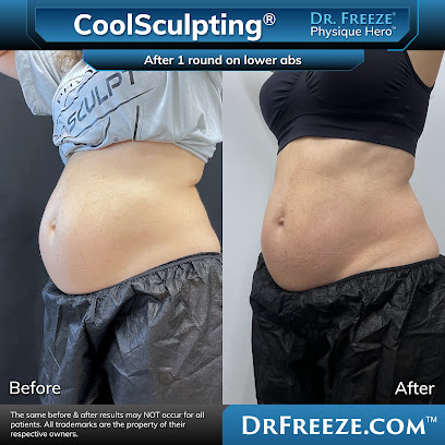 Photo 3 of Dr. Freeze CoolSculpting Center of Orange County