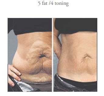 CryocareUSA Weight Loss , IV , Hydrafacial & Cryo Med Spa Irvine