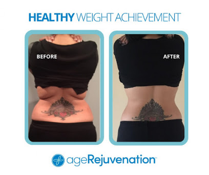 Photo 3 of AgeRejuvenation - Orlando