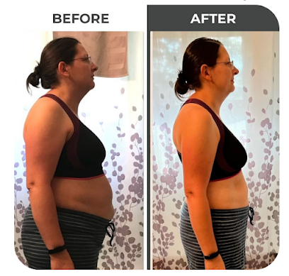 Photo 2 of Salt Lake City Fat Loss
