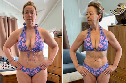 Photo 3 of Raleigh Weight Loss