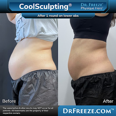 Dr. Freeze CoolSculpting Center of Orange County