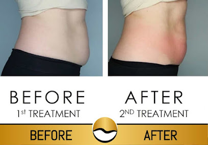 Renew Wellness Spa