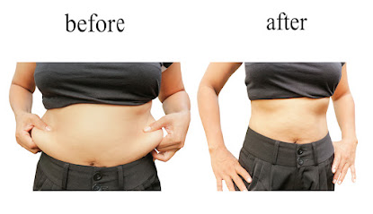 WildBerryMD Weight Loss, Wellness, & Med Spa