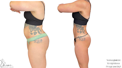 Shape Aesthetics and Wellness