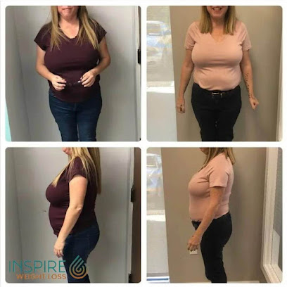 Photo 2 of Inspire Weight Loss