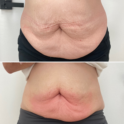 Desert Body Contour - Medical Spa