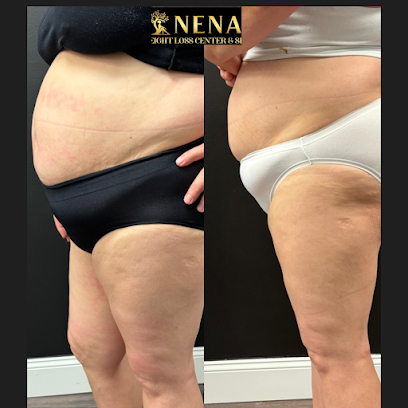 Photo 2 of Nena Weight Loss Center and SPA