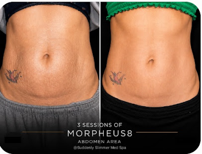 Suddenly Slimmer Med Spa