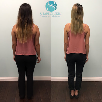 SHAPE & SKIN Medical Spa & Weight Loss